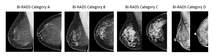 Breast (Chest) Density Information for Ontario Breast Screening